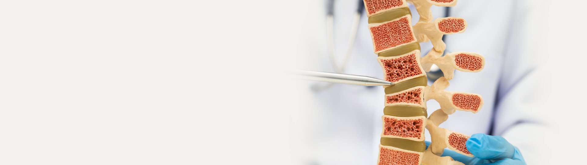 Testen Sie Ihr Osteoporose-Risiko: Unser kostenloser Risiko-Check