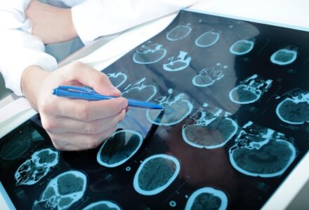 Radiologie Diagnosticum Visiorad